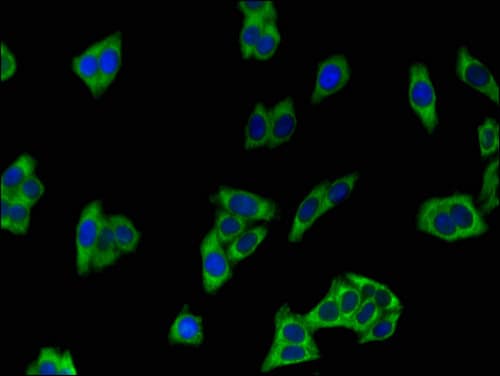 Polyclonal Rabbit anti-Human ATP8A2 Antibody (IHC, IF)