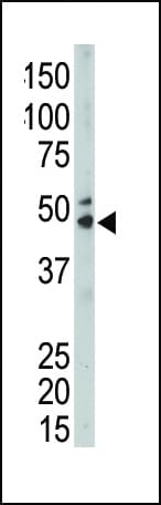 SPHK / SPHK1 Antibody (aa286-315)