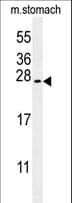 SERTAD3 Antibody (aa24-53)