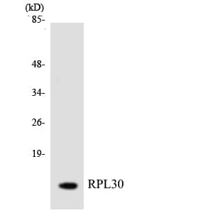 IHC-plus™ RPL30 / Ribosomal Protein L30 Antibody (aa62-111)