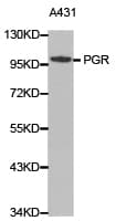 PR / Progesterone Receptor Antibody