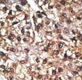 Polyclonal Rabbit anti-Human PINK1 Antibody (aa118-147, IHC, WB)