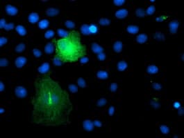 TMEFF2 Antibody (clone OTI1E4)
