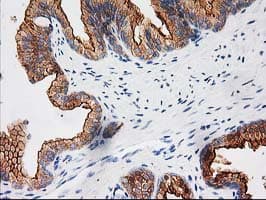 BAIAP2 / IRSP53 Antibody (clone OTI 1D9)