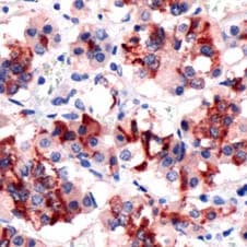 Polyclonal Rabbit anti-Human PRL / Prolactin Antibody (IHC)