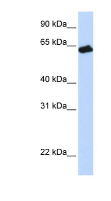 Polyclonal Rabbit anti-Human Growth Hormone Receptor / GHR Antibody (aa36-85, WB)