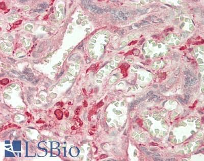 IHC-plus™ MMP7 / Matrilysin Antibody (aa 95-267)