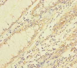 Polyclonal Rabbit anti-Human TRP32 / TXNL1 Antibody (WB)