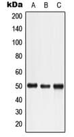 IHC-plus™ LTBR Antibody (N-Terminus)
