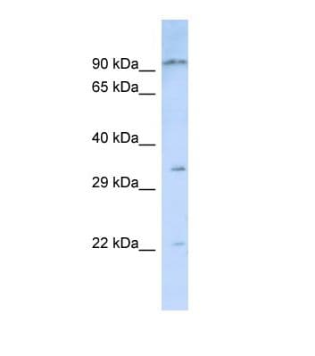 Polyclonal Rabbit anti-Human NIPSNAP3B Antibody (aa28-77, WB)