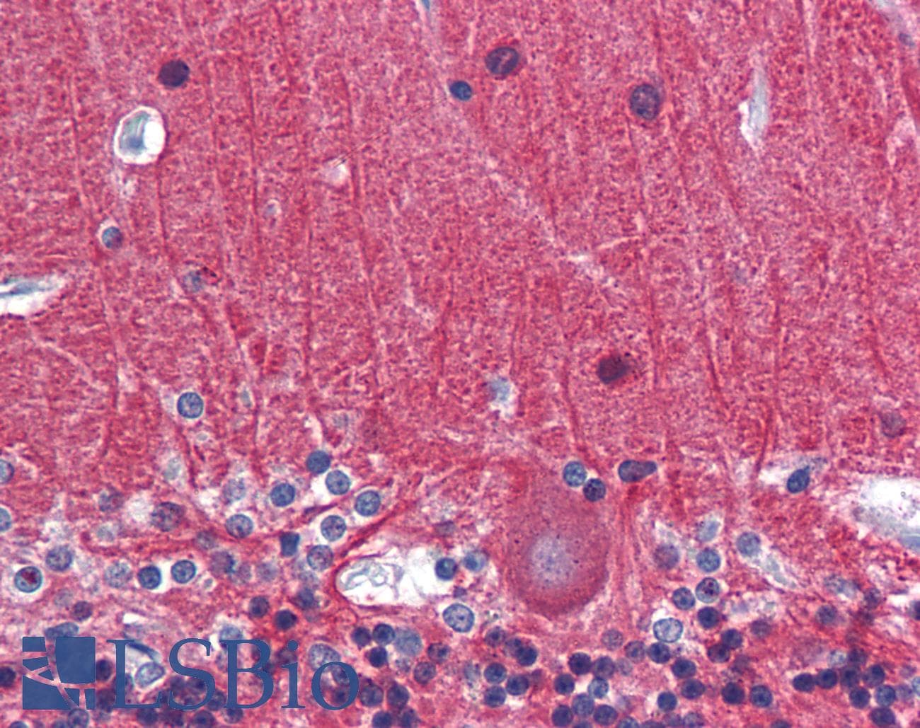 IHC-plus™ TUBA3C / Tubulin Alpha 3C Antibody (clone 3F10-2F2)