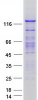 Human Smoothelin Protein (Recombinant Myc-DDK (Flag))