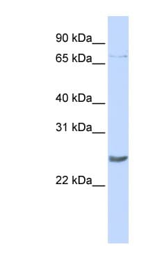 PRDM5 Antibody (C-Terminus)