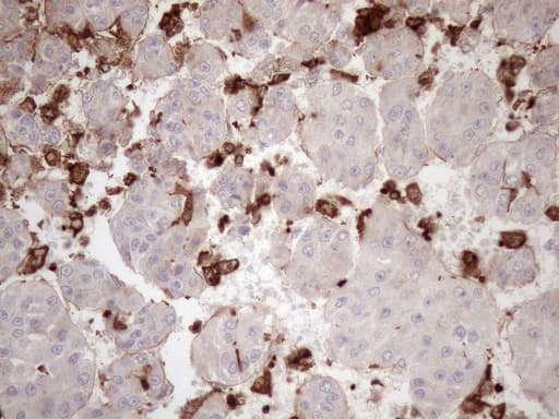 URP2 / FERMT3 Antibody (aa259-528, clone OTI2G2)