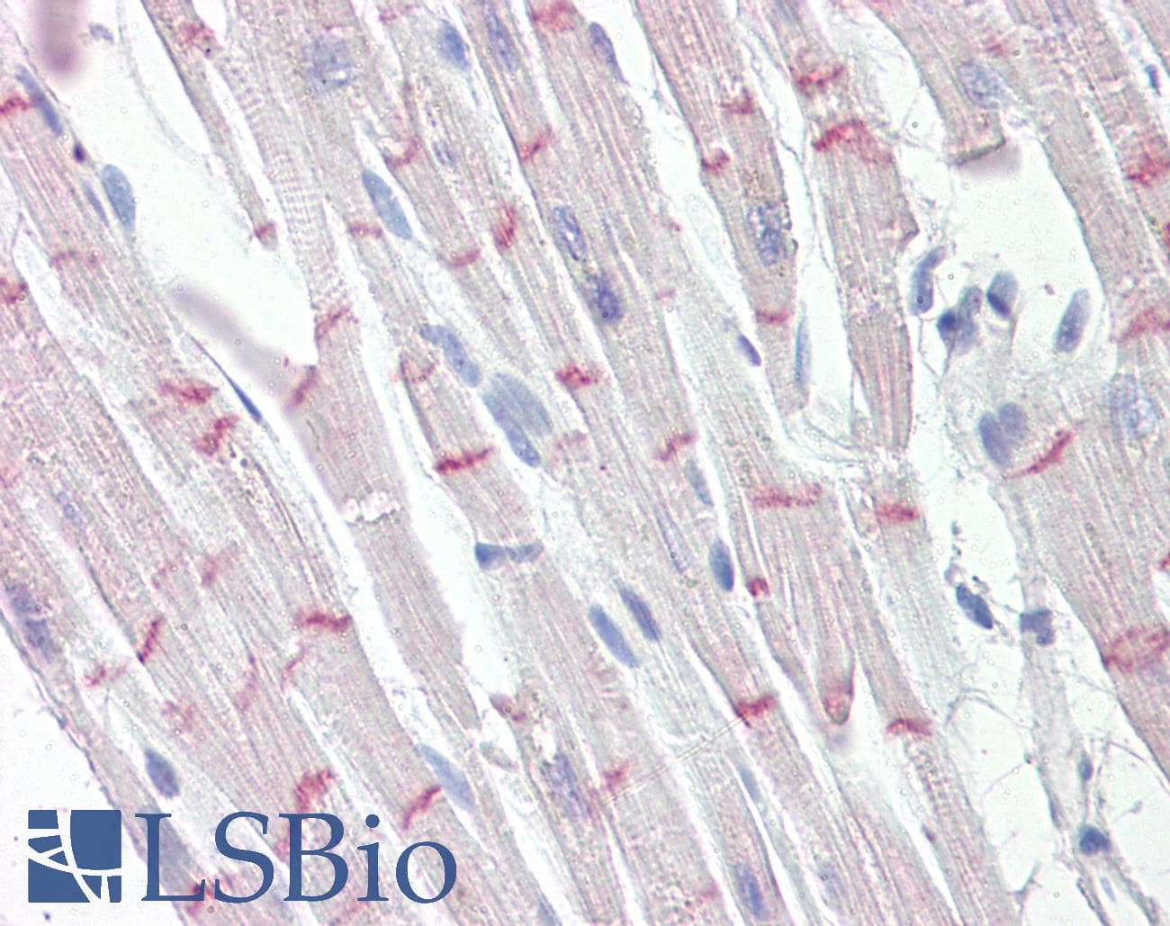 IHC-plus™ DSP / Desmoplakin Antibody (aa1672-1684)