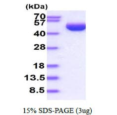 Human SERPINB3 Protein (Recombinant His)