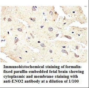 Polyclonal Rabbit anti-Human ENO2 / NSE Antibody (aa23-200, IHC, WB)