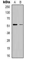 RSAD1 Antibody (Internal)