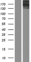 KNDC1 Protein (Over-Expression Lysate Myc-DDK (Flag))