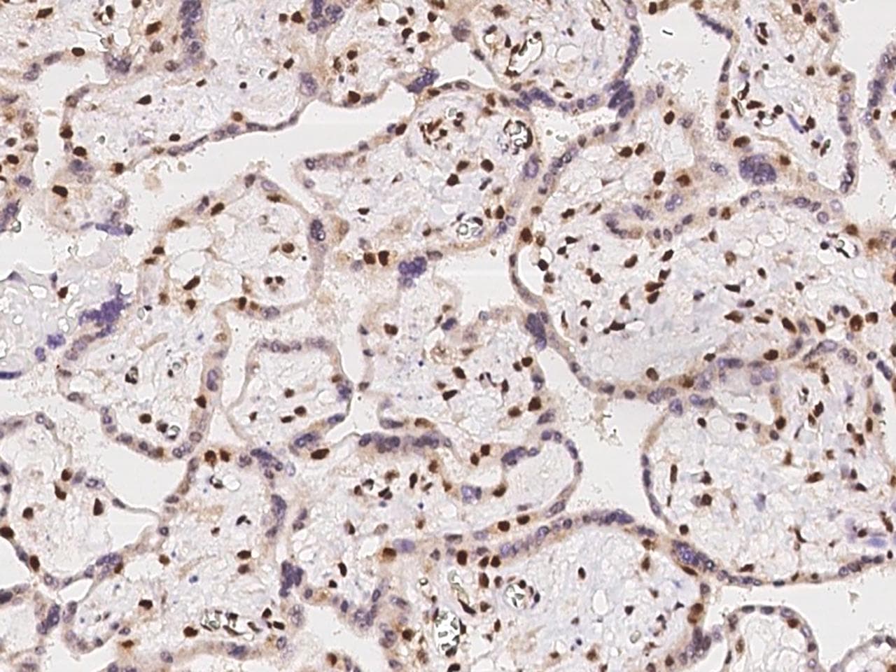 ACIN1 / Acinus Antibody