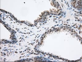 ERIC-1 / TACC3 Antibody (clone OTI8F6, Carrier-free)