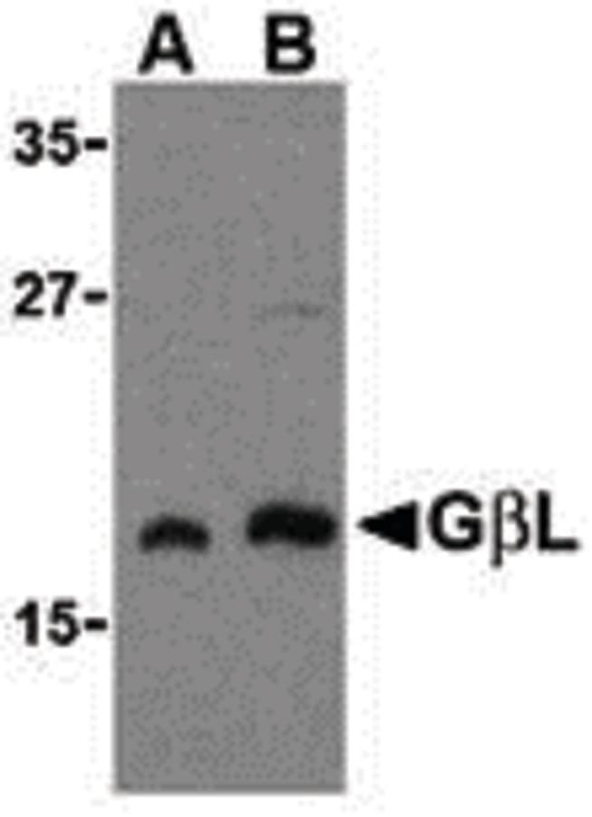IHC-plus™ MLST8 / GBL Antibody
