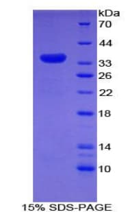 Rat MYO1D Protein (Recombinant His)