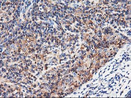 ENPEP / Aminopeptidase A Antibody (clone OTI3E7)