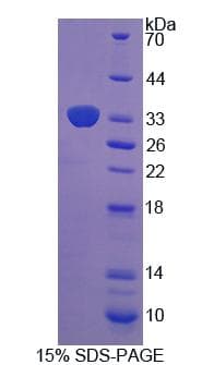 Mouse XYLT2 Protein (Recombinant His-T7)