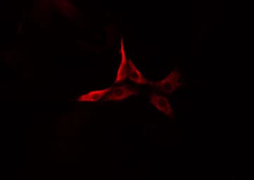 Polyclonal Rabbit anti-Human CNN2 Antibody (IF, WB)