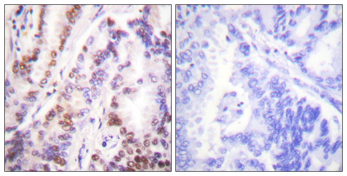 HDAC9 Antibody (aa1017-1066)