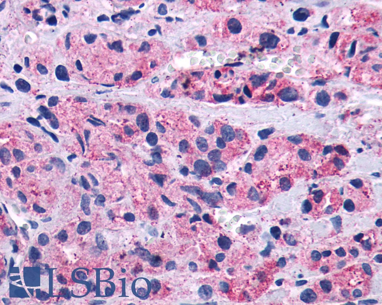 PathPlus™ Polyclonal Rabbit anti-Human LTB4R2 / BLT2 Antibody (C-Terminus, IHC)