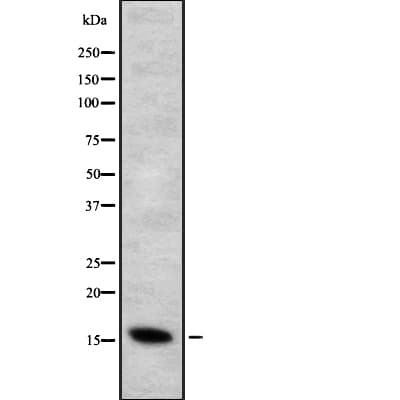 Polyclonal Rabbit anti-Human CYB5B Antibody (IHC, WB)