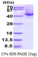 Human SPOP Protein (Recombinant His)