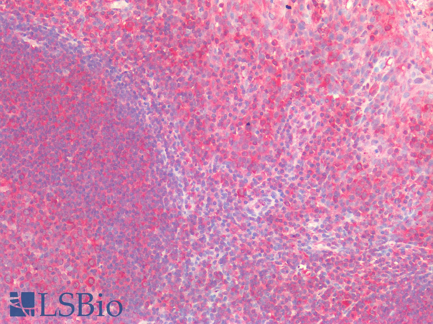 IHC-plus™ Polyclonal Rabbit anti-Human GAD1 / GAD67 Antibody (IHC)