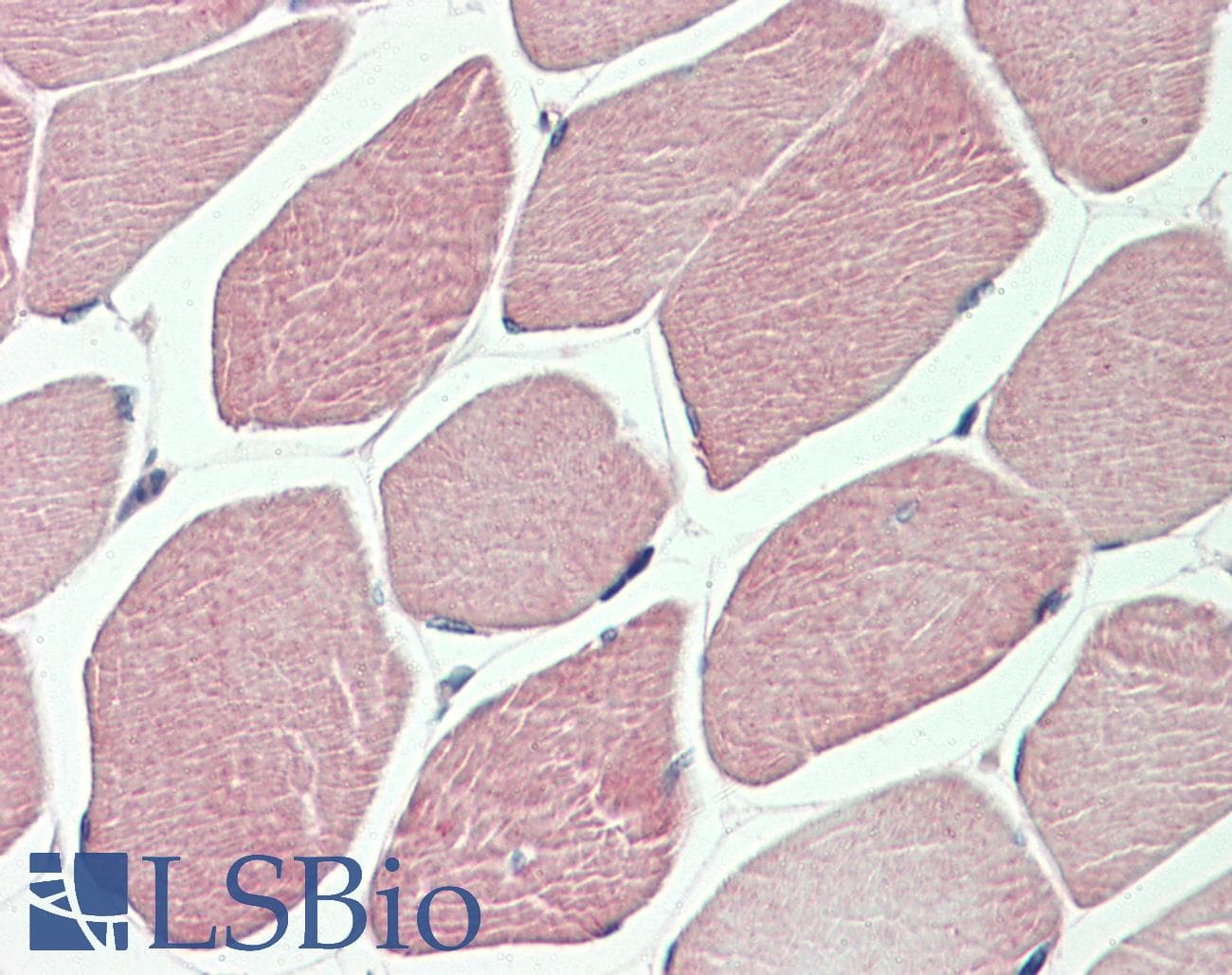 IHC-plus™ DVL1 / DVL / Dishevelled Antibody (aa20-32)
