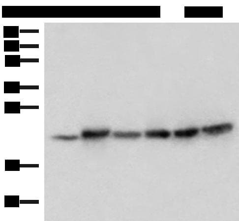 Polyclonal Rabbit anti-Human ATP5H Antibody (IHC, WB)