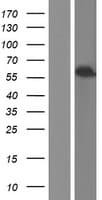 ALDH1A3 Protein (Over-Expression Lysate Myc-DDK (Flag))