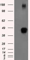Monoclonal Mouse anti-Human ZFP36 / Tristetraprolin Antibody (clone OTI8B5, IHC, IF, WB)