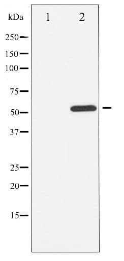 ATF2 Antibody (phospho-Thr69/51)