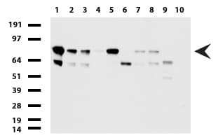 PARN Antibody (aa1-266, clone UMAB143)
