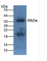 Apolipoprotein A-V Antibody (aa21-210)