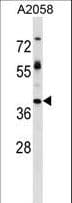 TPBG / 5T4 Antibody (aa169-197)
