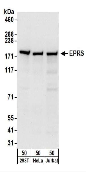 Polyclonal Rabbit anti-Human EPRS / PARS Antibody (aa275-325, IHC, WB)