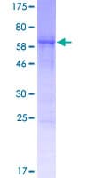 Human CCDC84 Protein (Recombinant GST)
