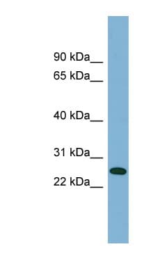 MIBP / ITGB1BP3 Antibody (aa107-156)