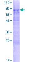 Human METTL14 Protein (Recombinant GST)
