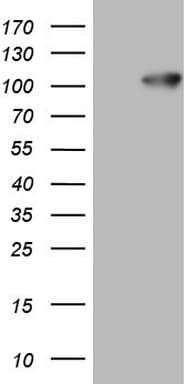 Monoclonal Mouse anti-Human FSIP1 Antibody (clone OTI7E3, WB)