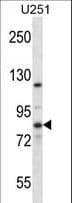 EIF2B5 Antibody (aa36-65)