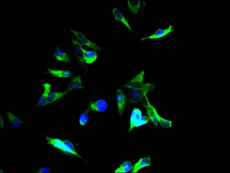 Polyclonal Rabbit anti-Human Tuberin / TSC2 Antibody (IF, WB)